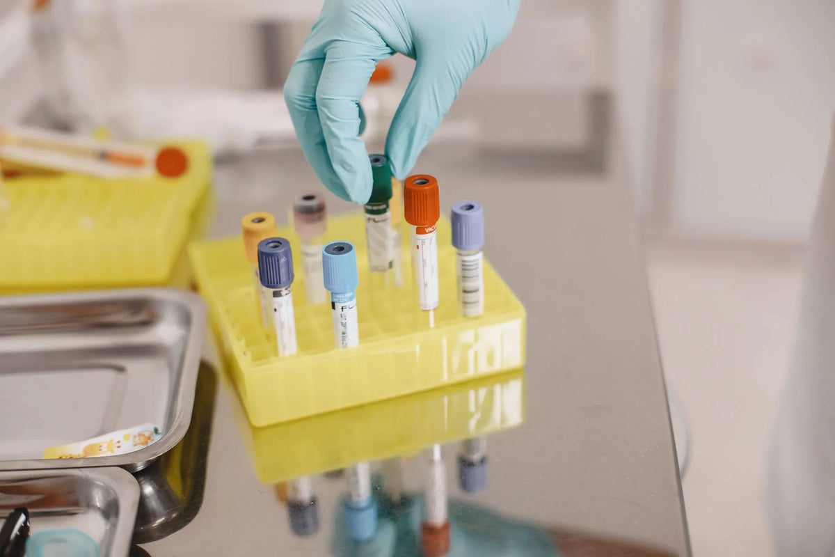 Close-up of blood collection vials
