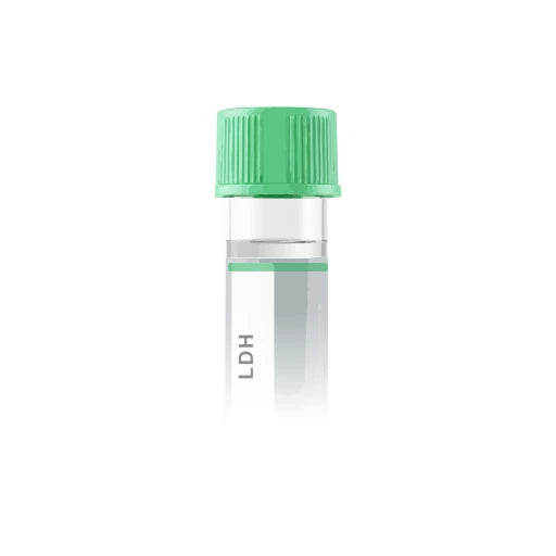 Lactate Dehydrogenase LDH lab test from Marek Diagnostics