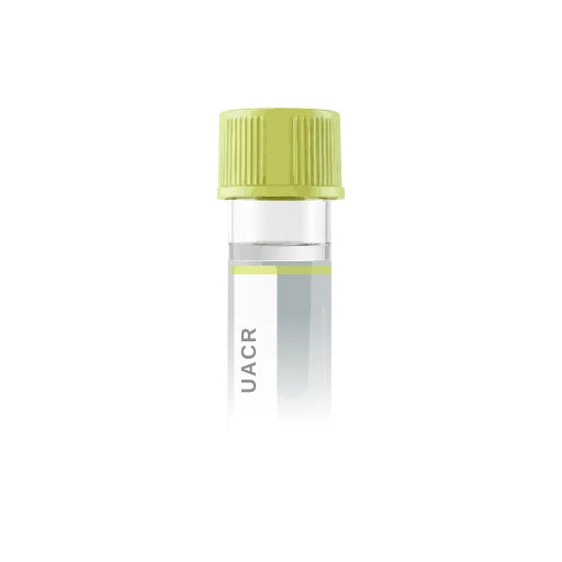Urine Albumin-Creatinine Ratio uACR lab test from Marek Diagnostics