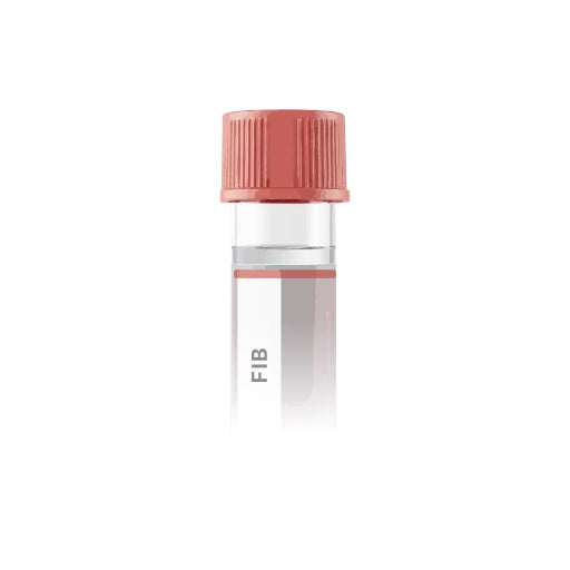 Fibrinogen (Factor I) Activity