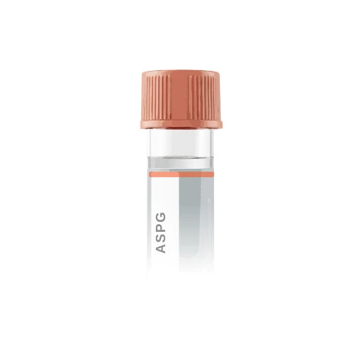 Aspergillus fumigatus IgE lab test from Marek Diagnostics