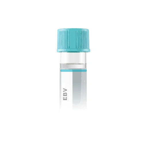 Epstein-Barr Virus EBV Antibody Panel lab test from Marek Diagnostics