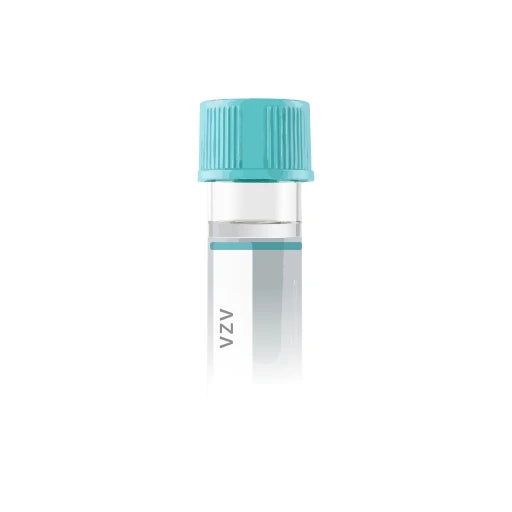 Varicella-Zoster Virus VZV Antibody IgG lab test from Marek Diagnostics